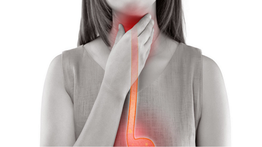 10 Home Remedies For Laryngitis That Might Help StylesXP